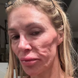 Estrela de reality show revela que vai 'tirar o rosto fora' por suposto parasita