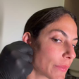 Mari Gonzalez mostra procedimento não cirúrgico para fechar orelha rasgada: