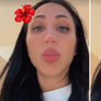 'Estou feia', diz Dayanne Bezerra após usar Ozempic para emagrecer Foto: Reprodução/Instagram