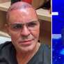 Eduardo Costa faz show careca: 'Não estou preocupado com minha aparência' Foto: Reprodução/Instagram / Contigo