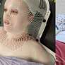 Mulher grávida de 44 anos achou que tinha distendido um músculo na aula de ioga, mas caroço na perna se revelou um câncer raro e incurável. Foto: Reprodução, Kennedy Notícias e Mídia / People / Purepeople