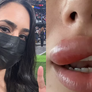 Médicas explicam problema de saúde que inchou a boca de Bruna Biancardi: 'Pode evoluir para uma meningite ou outra complicação maior'. Foto: Reprodução, Instagram / Purepeople