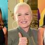 Médica faz alerta sobre doença que afeta Xuxa, Maiara, Deborah Secco e outras famosas: 'Provoca grande impacto estético e emocional'. Foto: AGNews / Purepeople
