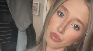 Jovem tem rosto desfigurado após ataque de cachorro e faz vaquinha para pagar cirurgia