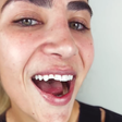 Filha de Leonardo exibe novo sorriso após arrumar os dentes quebrados em tombo