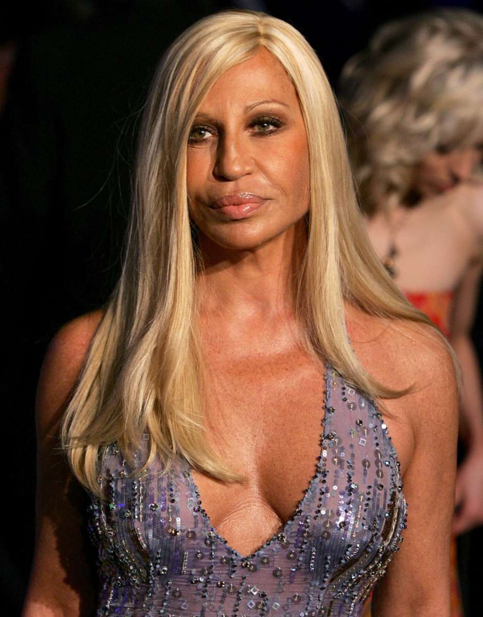 Nada natural! Veja mudanças no rosto de Donatella Versace