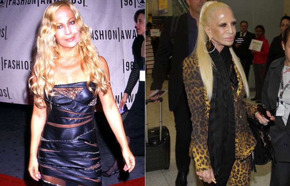 Nada natural! Veja mudanças no rosto de Donatella Versace