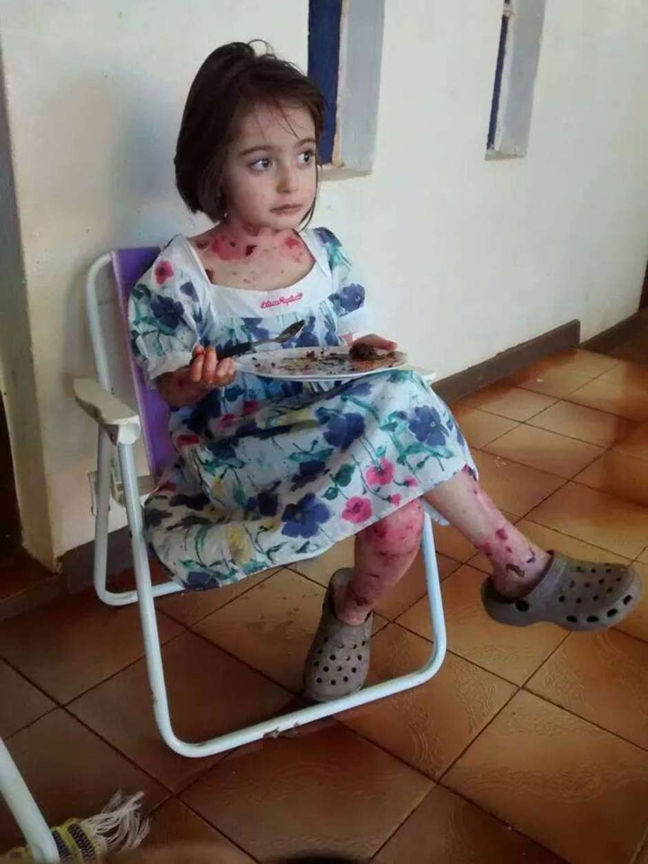 Caso Lavínia: menina com doença rara precisa de ajuda