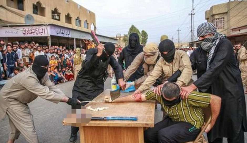 Resultado de imagem para fotos e imagens de condenados com as mãos cortadas no oriente médio