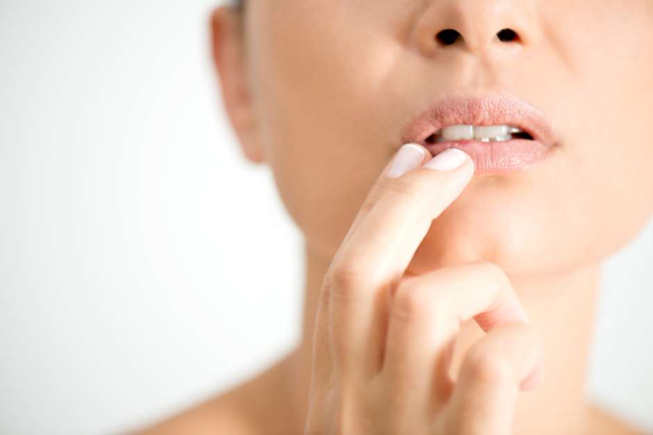 como se contrae el herpes labial