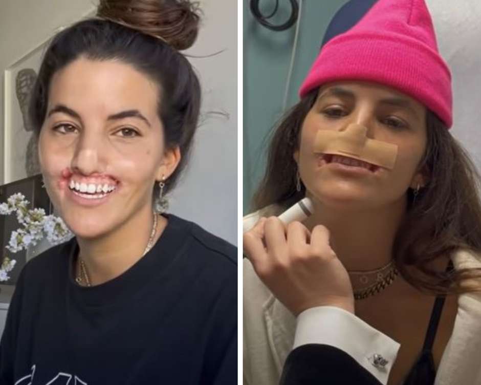 contioutra.com - Ataque de pitbull mudou o rosto de modelo &mdash; anos depois, ela revela resultado da reconstru&ccedil;&atilde;o