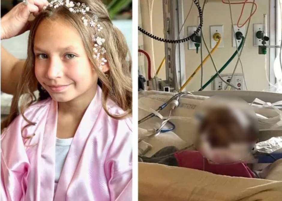 Menina de 9 anos sobrevive a raro ataque de puma durante trilha
