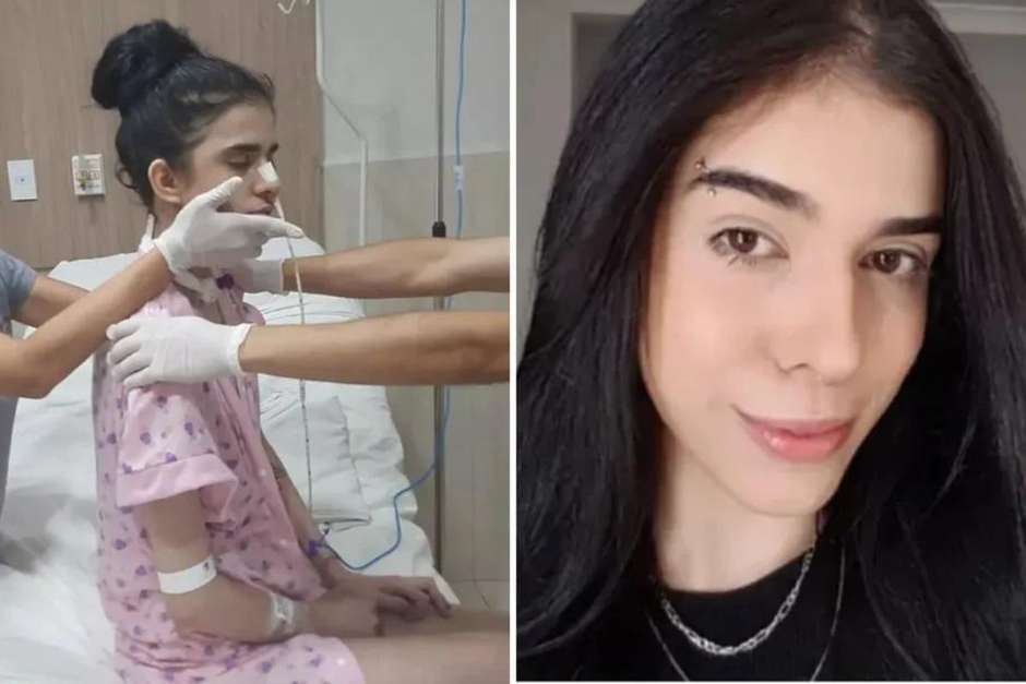 Jovem internada após cheirar pimenta apresenta evolução com fisioterapia