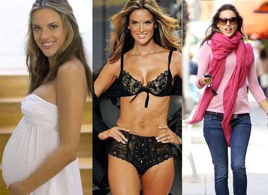 Famosas que bajar de peso antes y despues abdominoplastia