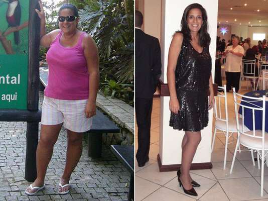 A consultora de seguros Carina Martins Ferreira, de 37 anos, realizou a operação. Depois de investir em todo tipo de dieta e lutar contra o efeito sanfona, seus 117 kg distribuídos em 1,78 m começaram a prejudicar as articulações, aumentar o colesterol e a pressão arterial