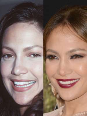 Dentes branquíssimos, perfeitamente alinhados para não ter vergonha na hora das fotos. O sorriso perfeito das celebridades é sonho de consumo de muita gente. Descubra com essa galeria que é possível conquistar um sorriso de dar inveja. Isso porque muitas das beldades que desfilam por aí também precisaram pedir uma forcinha para o dentista.