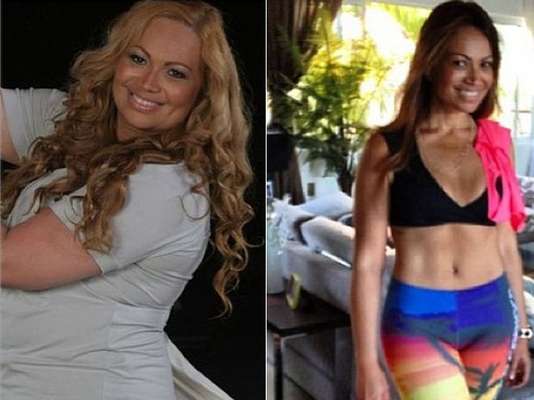Solange Almeida, do Aviões do Forró, postou nas redes sociais um depoimento sobre sua cirurgia de redução de estômago. A cantora comemora dia 31 de janeiro cinco anos da cirurgia. "Posso dizer que foi a melhor coisa que fiz na vida. Não falo isso apenas pela estética, mas pela qualidade de vida que voltei a ter", escreveu