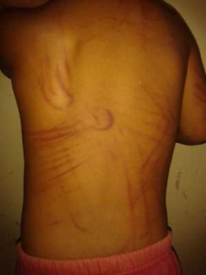 A mãe de uma criança de dois anos foi presa, na noite do último domingo, após ser denunciada por vizinhos por agredir sua filha com chicotadas, depois que ela queimou uma nota de R$ 5