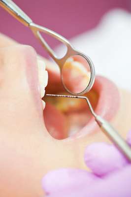 Las llagas en la boca - también conocidas como aftas - son típicas lesiones que afectan a un 80% de la población y pueden ser causadas por varios factores tales como el estrés, deficiencia vitamínica, problemas dentales y estomacales.