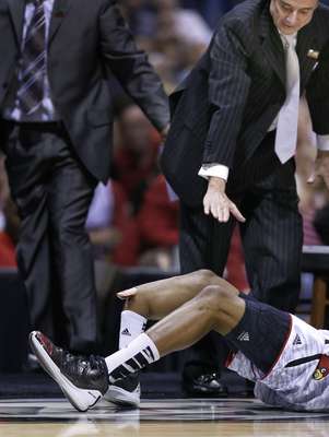 Um lance assustador marcou a partida entre Louisville e Duke, pelo NCAA, o basquete universitário dos Estados Unidos. No Lucas Oil Stadium, em Indianápolis: o armador Kevin Ware sofreu fratura gravíssima em sua perna direita e causou comoção entre os presentes