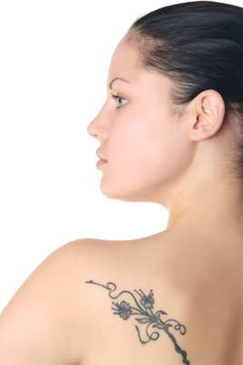 Técnicas de dermoabrasão e fototermólise seletiva, além da cirurgia, são as mais usadas para apagar a tattoo com sucesso