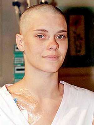 A atriz Carolina Dieckmann raspou a cabeça para viver a personagem Camila na novela Laços de Família em 2000. Na trama, ela foi diagnosticada com câncer