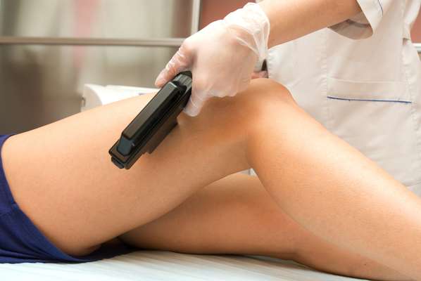 Depilação a laser não só deixa a cútis lisinha, mas também a mantém livre de problemas cutâneos provocados por pelos encravados e foliculite