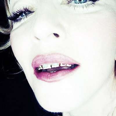 Madonna postou em seu Instagram uma foto exibindo os grillz com a legenda: "Não me odeie. Odeie meu grillz"