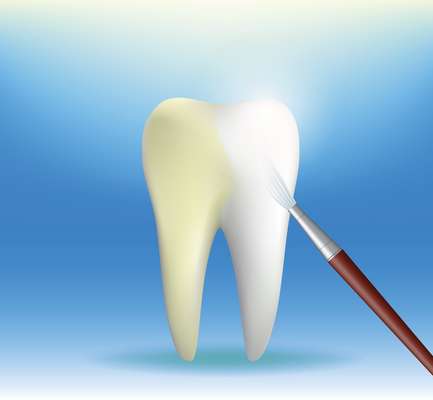 O uso da água oxigenada para clarear os dentes pode resultar em prejuízos bastante significativos, principalmente se a utilização for indiscriminada