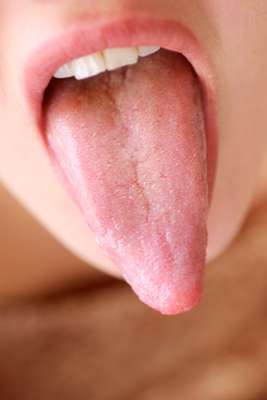 1. Cirurgia plástica na línguaCriado por um cirurgião de Beverly Hills, o procedimento dura apenas 10 minutos. O médico costura uma espécie de adesivo na língua, com seis pontos. O dispositivo faz com que a mastigação de alimentos sólidos seja tão dolorosa que obriga a pessoa a ingerir apenas líquidos