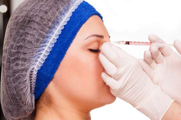 Micro-Botox é usado apenas para relaxar a expressão, sem travá-la