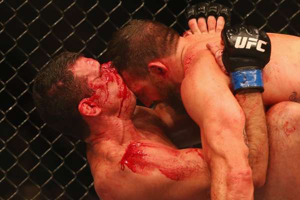 6/12 - O UFC Fight Night 33, realizado na austrália, deixou o octógono "banhado" de sangue, já que diversos lutadores sofreram ferimentos durante as lutas. Anthony Perosh (esq.) foi um deles