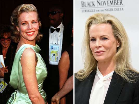 Este es un antes y después de Kim Basinger. La foto de la izquierda es en 1998 cuando obtuvo el Oscar y la otra de la actualidad ¿Cuál es la diferencia?