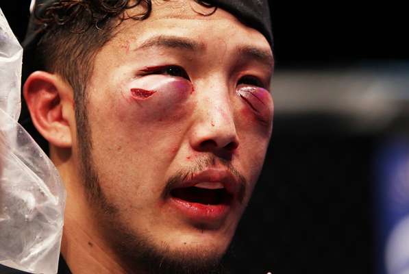 UFC Fight Night 37, em 1 de março: em luta contra Yui Chul Nam, Kazuki Tokudome saiu com muitos ferimentos no rosto e derrota por decisão dividida dos juízes