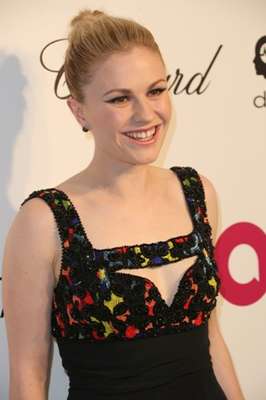 Anna Paquin: a pesar de tener sus dientes frontales muy separados, la actriz neozelandesa, ganadora de un Óscar con tan solo once años, parece no importarse con esta irregularidad.