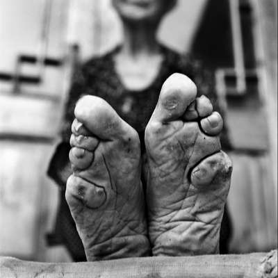 Há mais de 100 anos a prática centenária de amarrar os pés das mulheres para evitar que eles cresçam foi banida na China, mas ainda há mulheres vivas que mostram os resultados deste costume