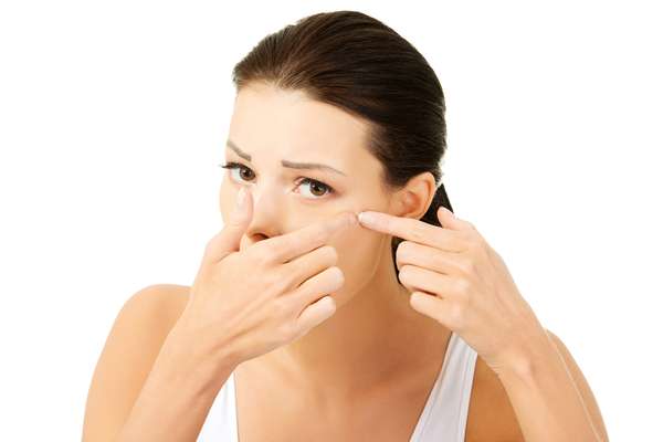 A acne se desenvolve quando os poros da pele ficam obstruídos por excesso de oleosidade, células mortas e bactérias. Ela costuma aparecer no rosto, pescoço, busto, costas e ombros, áreas mais com mais glândulas sebáceas
