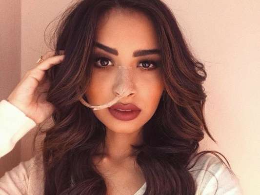 A modelo Nara Almeida morreu nesta madrugada de segunda-feira (21)