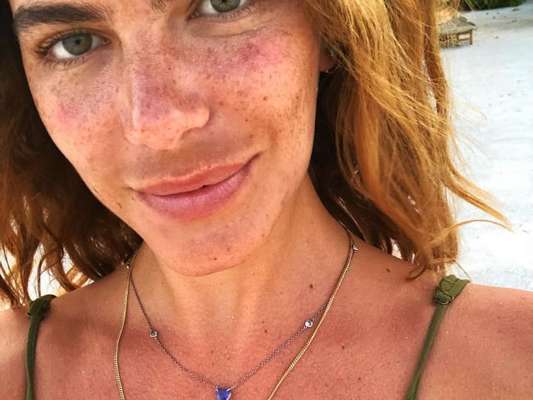 Mariana Goldfarb postou foto sem maquiagem e explicou mancha na área do buço: 'Para quem está falando lá na foto sobre o protetor solar, do melasma, então... Eu tenho, infelizmente, aqui no bigode'