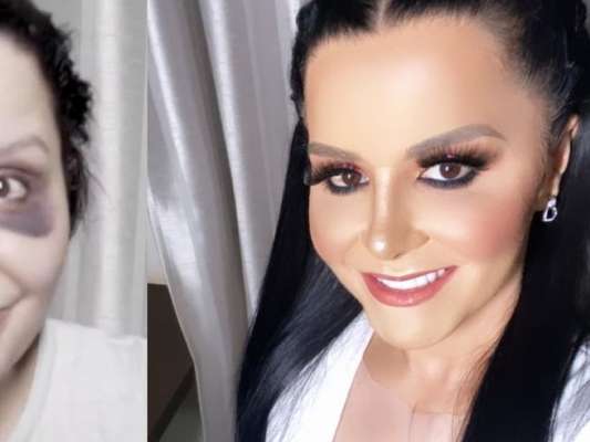 Dupla de Maiara, Maraisa impressiona ao filmar antes e depois de maquiagem após plástica no nariz neste sábado, dia 11 de janeiro de 2020