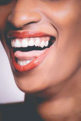 Clareamento dentário sem supervisão Não recorra aos tutoriais da internet ou dicas caseiras para clarear os dentes. É muito comum pessoas procurarem um dentista quando o pior já aconteceu, os dentes não atingiram a cor ideal ou ficaram com muita sensibilidade. Além de poder “queimar a gengiva”, a falta de uma orientação ou uso incorreto do produto, podem causar sérios danos à saúde. Para realizar clareamento dentário, o paciente deve estar com gengiva saudável, sem acúmulo de placa, cálculo dental e cáries. Além disso, é indicado um polimento prévio para melhor ação do gel clareador. É possível realizar clareamento dentário sem sensibilidade, quando há o acompanhamento de um profissional durante todo o processo.