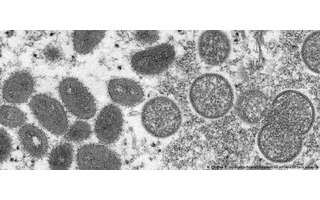 Vírus da varíola dos macacos: variante da África Ocidental é menos contagiosa e mais branda que a da África Central