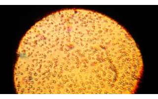 Imagem microscópica de uma amostra de leite materno humano