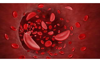Anemia: conheça os tipos e as causas da síndrome anêmica