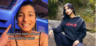 Natasha Santana contou com detalhes como passou pelas cirurgias de retirada de crânio