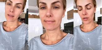 Sem maquiagem e abatida, Ana Hickmann garantiu aos fãs que vai superar o momento difícil na vida privada