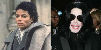 <p>Michael Jackson em 1987 (à esquerda) e depois de tratamentos (à direita)</p>