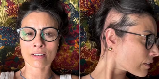 Ex-apresentadora britânica Melanie Sykes, de 55 anos, comoveu seguidores ao compartilhar um vídeo nas redes sociais em que mostra a perda de cabelo causada pela alopecia