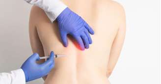 A ozonioterapia pode ser feita em diversas partes do corpo