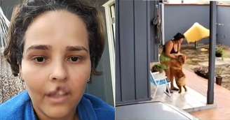 Mulher teve lábio arrancado por cachorro em RO